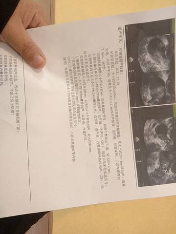 journal_insert_pic_1683098344