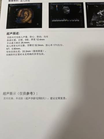 journal_insert_pic_1675556723
