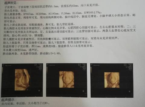 journal_insert_pic_1685708221