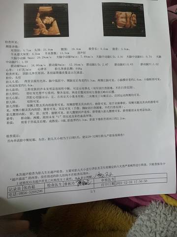 journal_insert_pic_1683713453