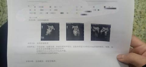 journal_insert_pic_1683163502