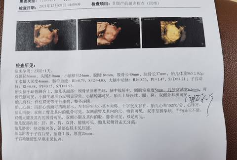 journal_insert_pic_1676818272