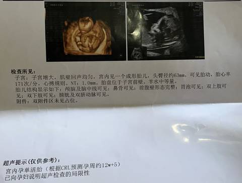 journal_insert_pic_1674173688