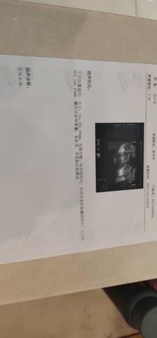 journal_insert_pic_1674695213