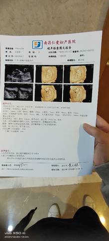 journal_insert_pic_1683028323