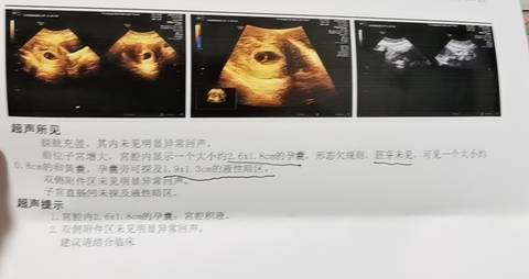 journal_insert_pic_1686383736