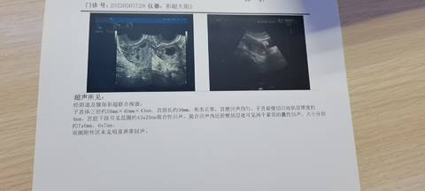 journal_insert_pic_1719694013