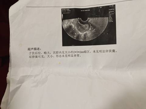 journal_insert_pic_1684434899