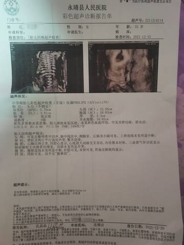 journal_insert_pic_1683187226