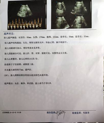 journal_insert_pic_1678682783