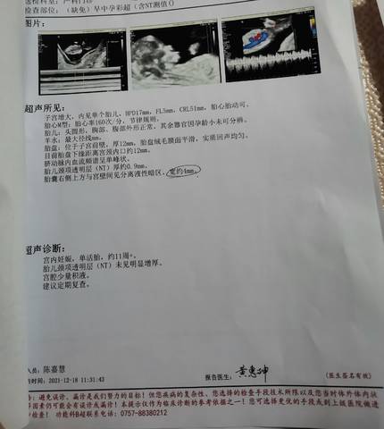journal_insert_pic_1690380239