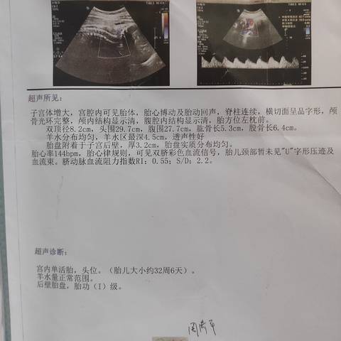 journal_insert_pic_1677423351