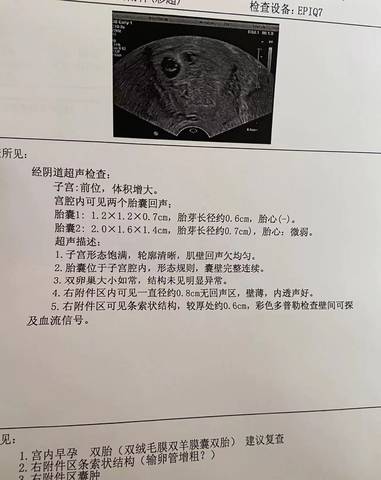 journal_insert_pic_1682405411