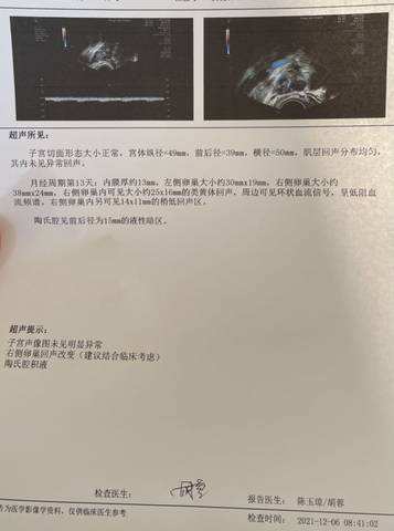 journal_insert_pic_1674662772