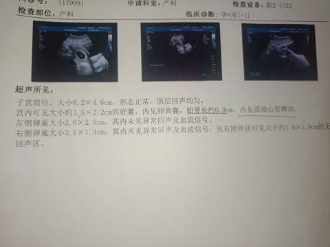 journal_insert_pic_1679983968