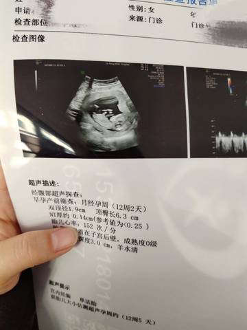 journal_insert_pic_1690284846