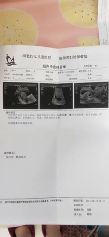 journal_insert_pic_1679514655
