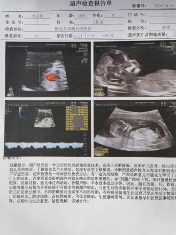 journal_insert_pic_1686334768