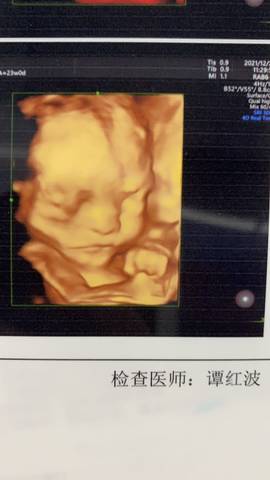 journal_insert_pic_1686440215