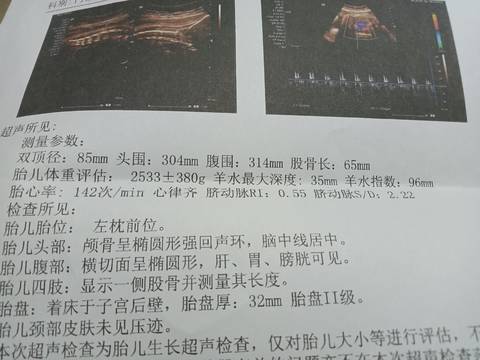 journal_insert_pic_1683313255