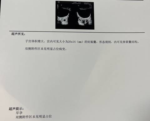 journal_insert_pic_1686453084