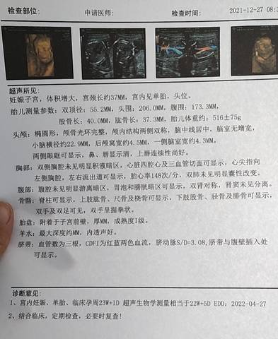 journal_insert_pic_1686985097