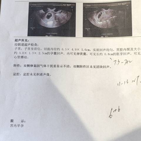 journal_insert_pic_1684248202