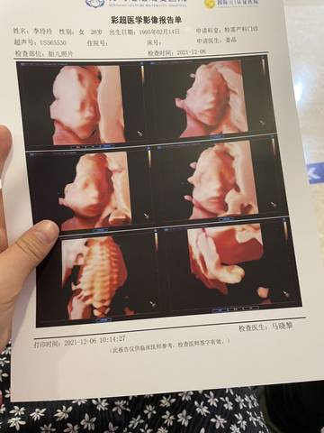 journal_insert_pic_1686114064