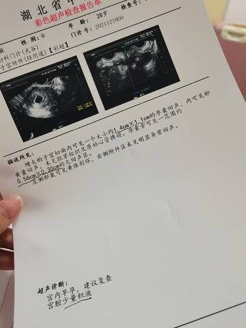 journal_insert_pic_1682096556