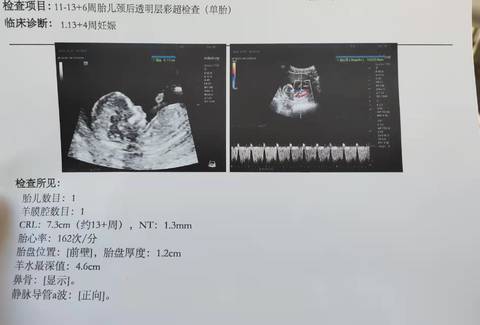 journal_insert_pic_1674605076