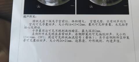 journal_insert_pic_1687776737