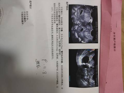 journal_insert_pic_1683171192