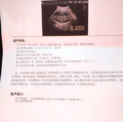 journal_insert_pic_1673061782