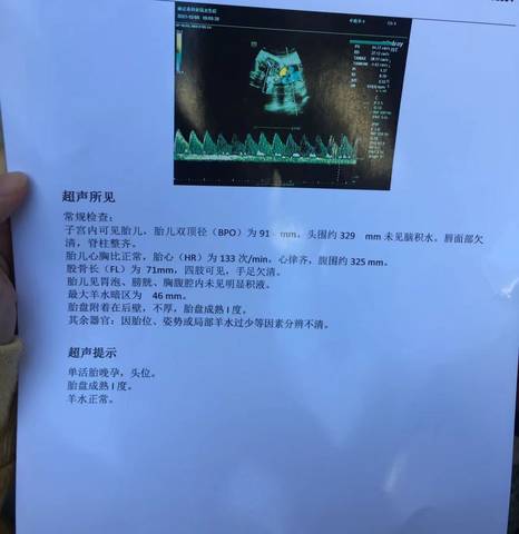 journal_insert_pic_1673844828