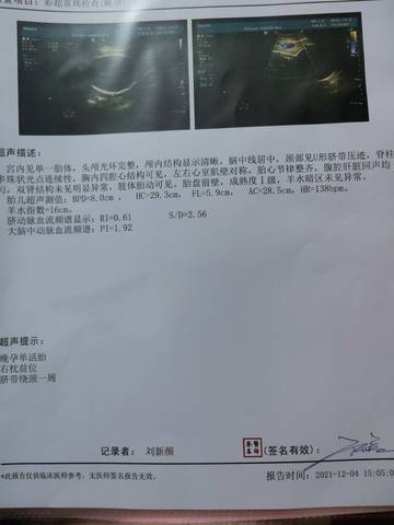 journal_insert_pic_1673697925