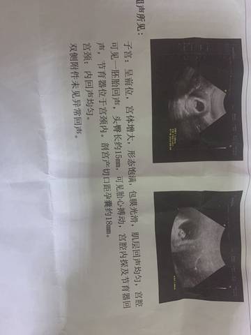 journal_insert_pic_1685631212