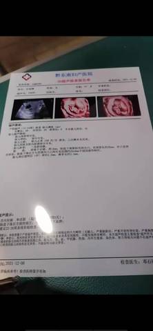 journal_insert_pic_1676004541