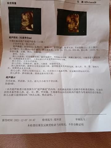 journal_insert_pic_1678911005