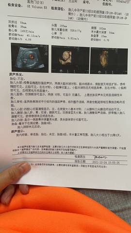 journal_insert_pic_1685395556