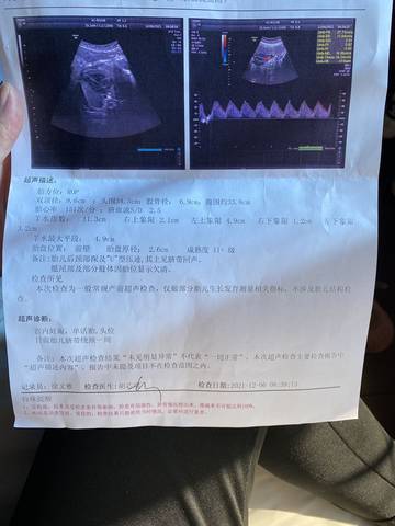 journal_insert_pic_1674689662