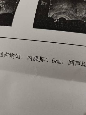 journal_insert_pic_1675512056