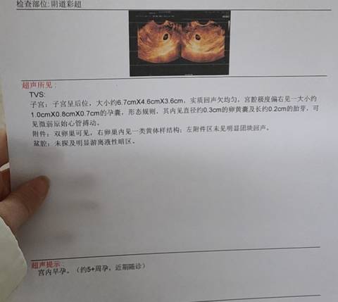 journal_insert_pic_1690057508