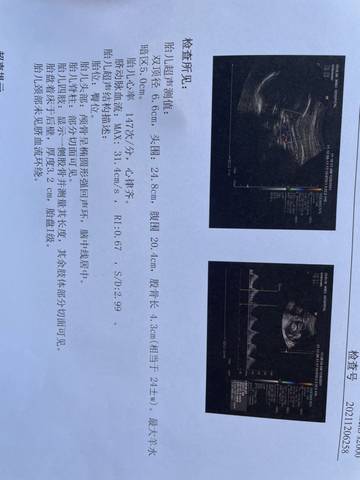 journal_insert_pic_1674843264