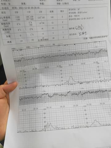 journal_insert_pic_1683054349