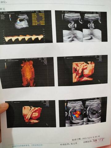 journal_insert_pic_1674683095