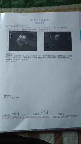 journal_insert_pic_1684897419