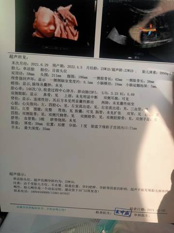 journal_insert_pic_1675968574