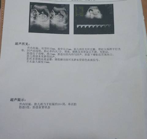 journal_insert_pic_1690044648