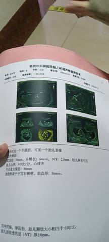 journal_insert_pic_1719535893