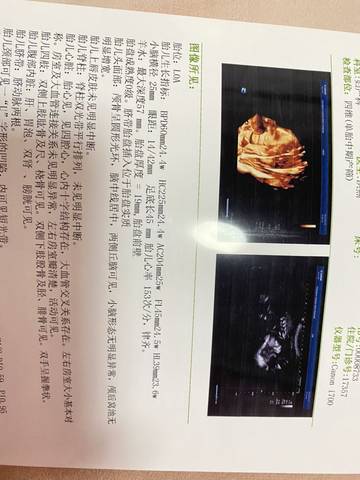 journal_insert_pic_1719903424